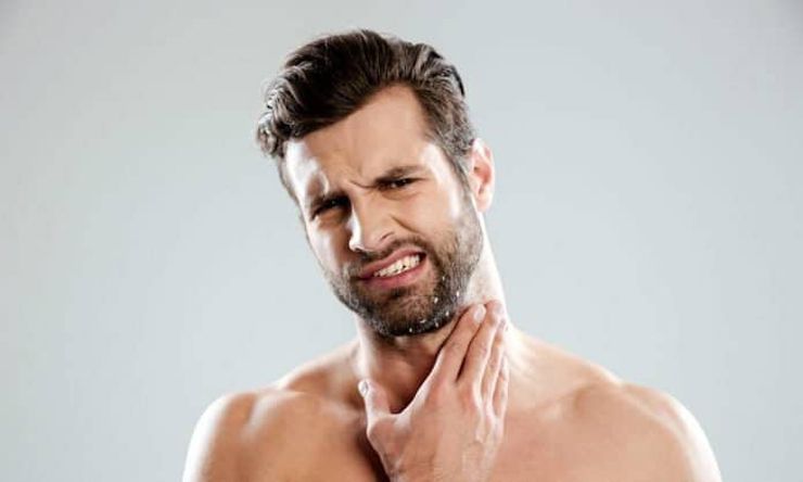 اپنے داڑھی کی خشکی اور کھجلی ، چمکیلی جلد سے ایک ہفتہ کے اندر چھٹکارا حاصل کرنے کے لئے 4 تعریفیں