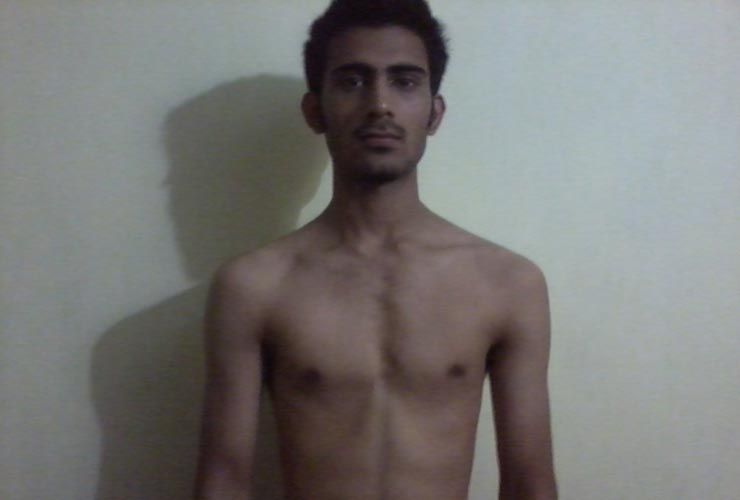 Fra at være tynd til konkurrencedygtig naturlig bodybuilding, viser Vivek, at meget kan gøres uden steroider