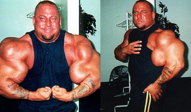 L'histoire du bodybuilder le plus détesté au monde et de ses bras explosifs