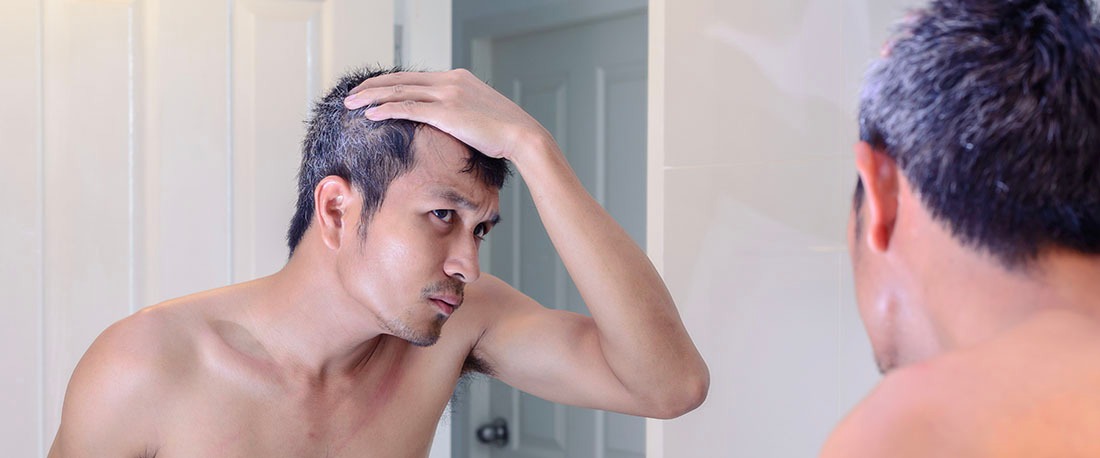 3 Arten von Haarausfall aufgrund von Stress zusammen mit den sichtbaren Zeichen, um sie zu erkennen