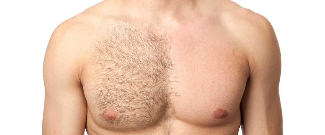 En mann med halvt trimmet brysthår
