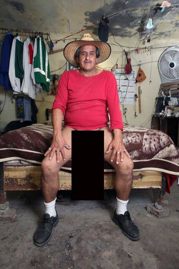 Denne meksikanske mannen med verdens største penis er nå registrert som funksjonshemmet og lever på fordeler