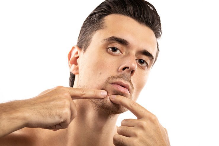 5 modi super facili per smettere di ottenere peli incarniti sul viso dopo la rasatura