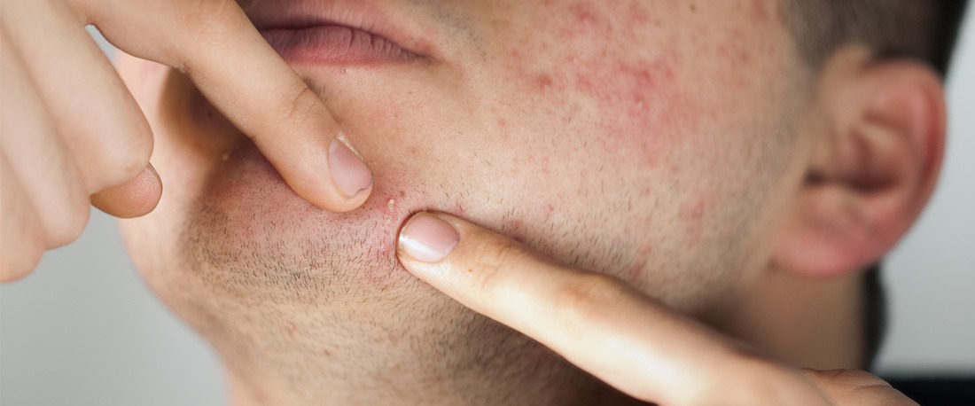 त्वचा के लिए ग्रीन टी के 5 लाभ जो पुरुषों के लिए उनके 20 के दशक में होने चाहिए