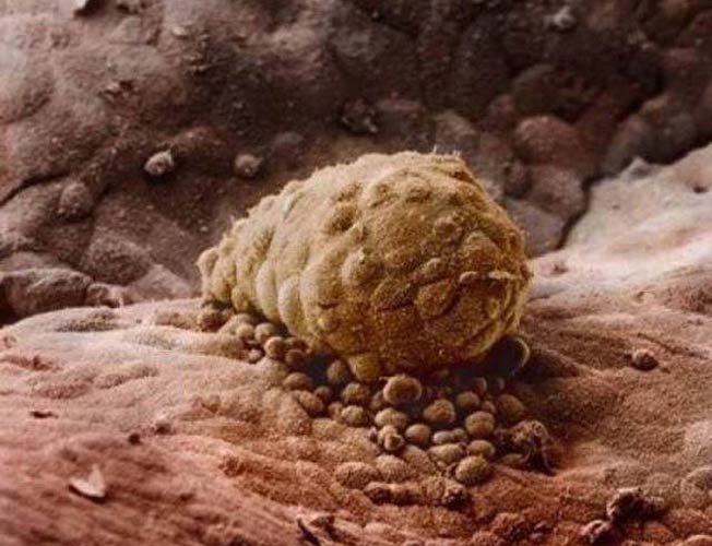 एक गर्भ के अंदर भ्रूण के विकास की तस्वीरें