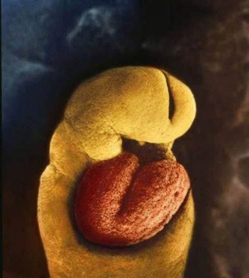 Снимки на плода, развиващ се в матката