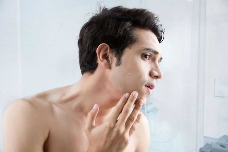 5 dôvodov, prečo je gél z aloe vera skvelým domácim liekom na vašu pokožku