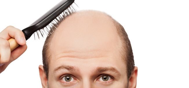 A vékonyodó hajú férfiak által elkerülendő dolgok