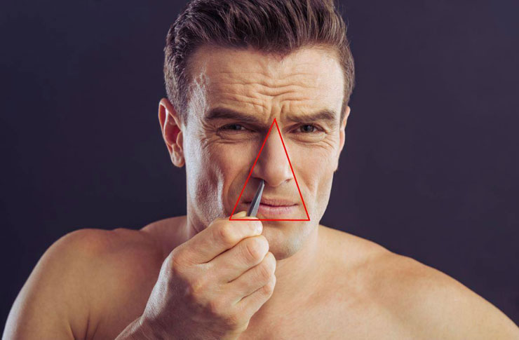 Estas son 4 alternativas más seguras para hacer estallar las espinillas en el área del 'triángulo de la muerte' en la cara